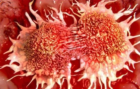 DESCOPERIRE MEDICALA: ALIMENTUL CARE UCIDE 85% DIN CELULELE CANCERULUI PULMONAR
