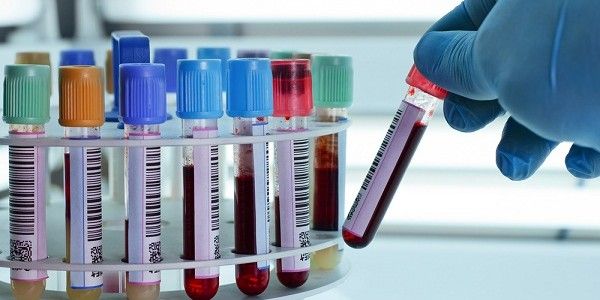 Șase elevi de la Liceul cu Program Sportiv Arad au ajuns în spital, dar nimeni nu are o explicație