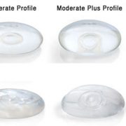 Implanturile mamare: Beneficii și dezavantaje ale celei mai întâlnite metode de îmbunătățire a imaginii