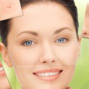 De ce e acneea, o afecțiune fizică și psihică (si cum poti sa scapi de ea)