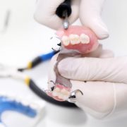 Cum se efectueaza implantul dentar pentru toata gura?