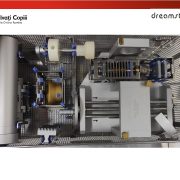 Cazul copilului electrocutat pe un vagon de tren: Salvați Copiii România a dotat singura Unitate Functională de Arşi de uz pediatric din regiunea Moldovei